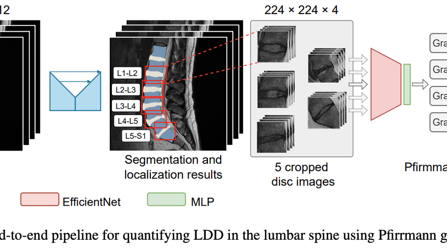 A stronger baseline for automatic Pfirrmann grading of lumbar spine MRI using deep learning